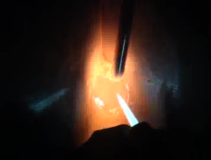 11. Fillet weld, inside corner, vertical (3F) position