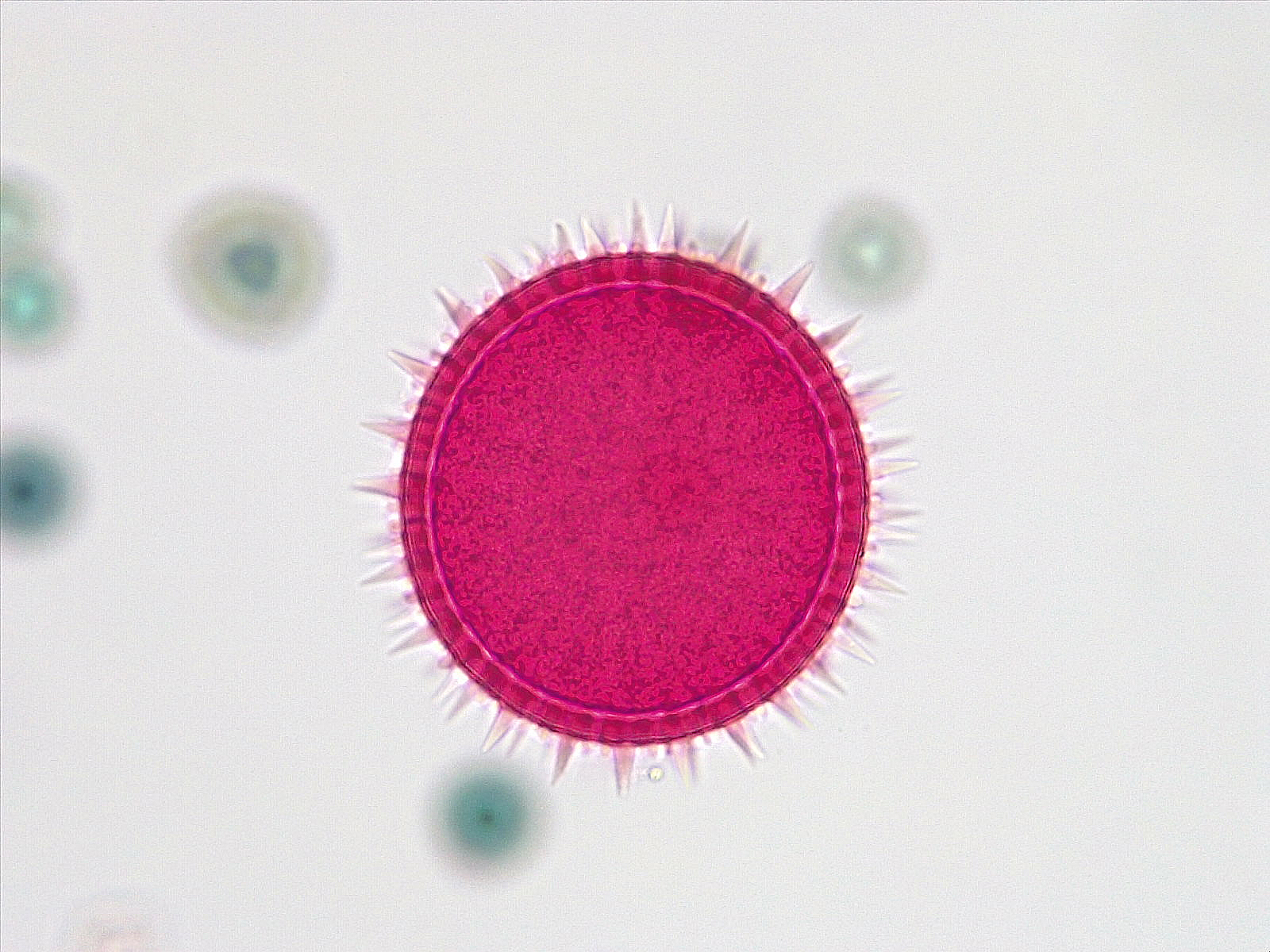 Angiosperm and Gymnosperm Reproduction