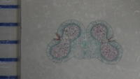 Lilum anther mat cs 18