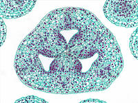 Lilum ovary top cs 11 10x