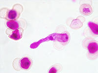 Pinus pollen germed wm 18 40x