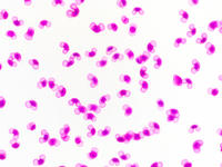 Pinus pollen mat wm 10 10x