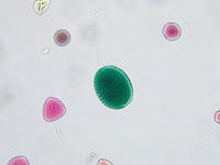 Pollen 5types wm 11 40x