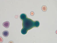 Pollen 5types wm 12 40x