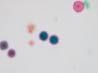 Pollen 5types wm 16 40x