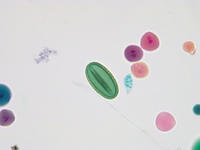 Pollen 5types wm 17 40x