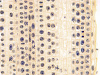 Onion root tip ls 22 40x