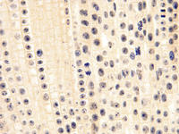 Onion root tip ls 26 40x