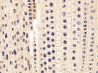 Onion root tip ls 29 40x