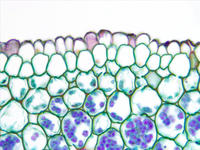 Dicot root cs 22 40x