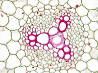 Ranunculus root yng cs 13 40x