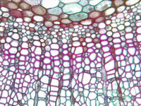 tilia_stem_yr1_cs_7_40x