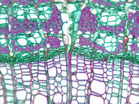 tilia_stem_yr2_cs_17_40x