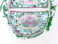 pinus_leaf_needle_cs_2_10x