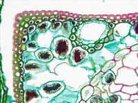pinus_leaf_needle_cs_11_40x