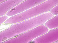 red_onion_epidermis_37_40x