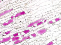 red_onion_epidermis_47_10x