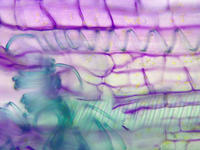 tomato_stem_old_ls_tbo_10_40x