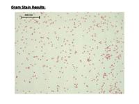 E. coli data set (.pptx version)