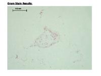 S. flexneri data set (.odp version)
