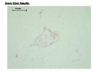 S. flexneri data set (.pptx version)