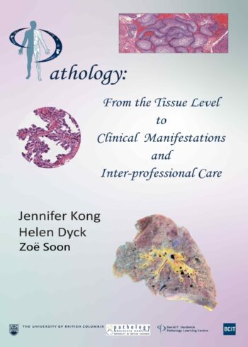 Pathology