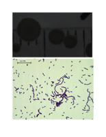 Unknown Bacteria Assignment (Beginner Version)